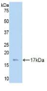 LAMC3 / Laminin Gamma 3 Antibody (aa751-875)