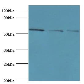 IHC-plus™ BBS4 Antibody (aa350-519)