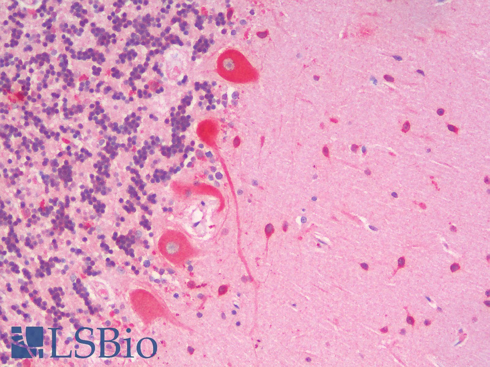 IHC-plus™ SLC7A6 Antibody (C Terminus)