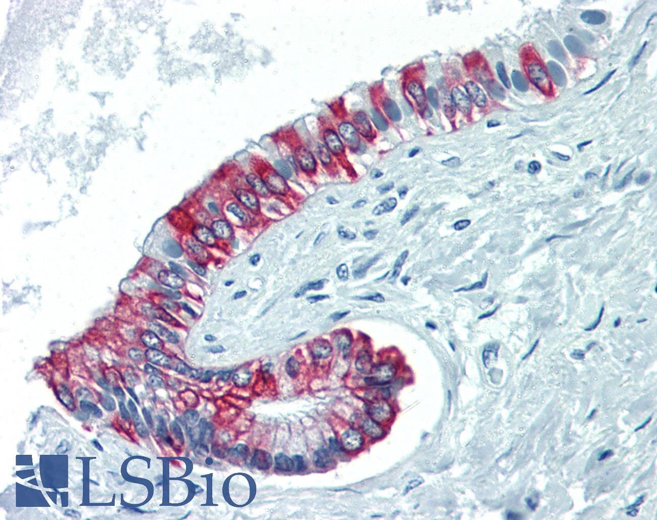 IHC-plus™ KRT8 / CK8 / Cytokeratin 8 Antibody (C-Terminus, clone R15-K)