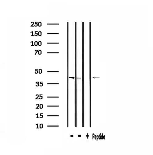 Polyclonal Rabbit anti-Human ARRDC3 Antibody (IF, WB)