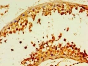DCP2 Antibody (aa1-385)