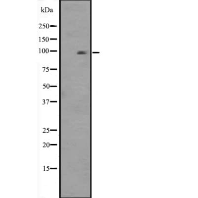 Polyclonal Rabbit anti-Human HSPA4L / APG-1 Antibody (WB)