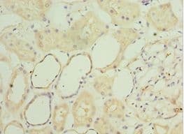 Polyclonal Rabbit anti-Human SGSH Antibody (aa273-502, IHC)
