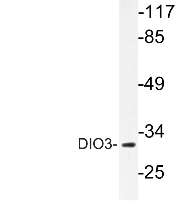 DIO3 Antibody (aa17-66)