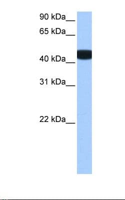 BCKDK Antibody (aa111-160)