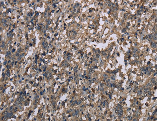 MCC Antibody