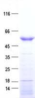 Human HORMAD1 Protein (Recombinant His, N-Terminal)