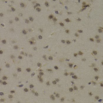 PAWR / PAR4 Antibody