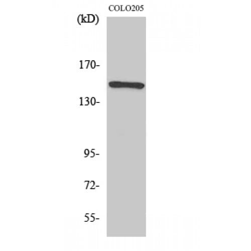 RAD50 Antibody (650-730 aa, Internal)