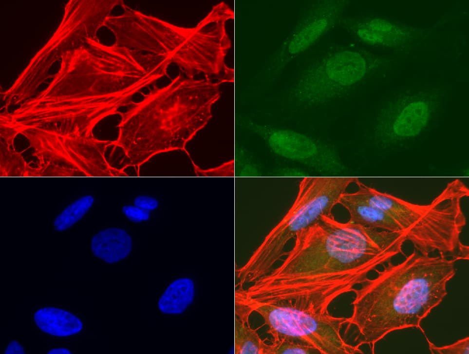 AMACR / P504S Antibody (clone UMAB68, Carrier-free)