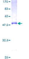 Human CLEC3B / Tetranectin Protein (Recombinant GST)