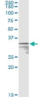 MPST Antibody (clone 1B5)