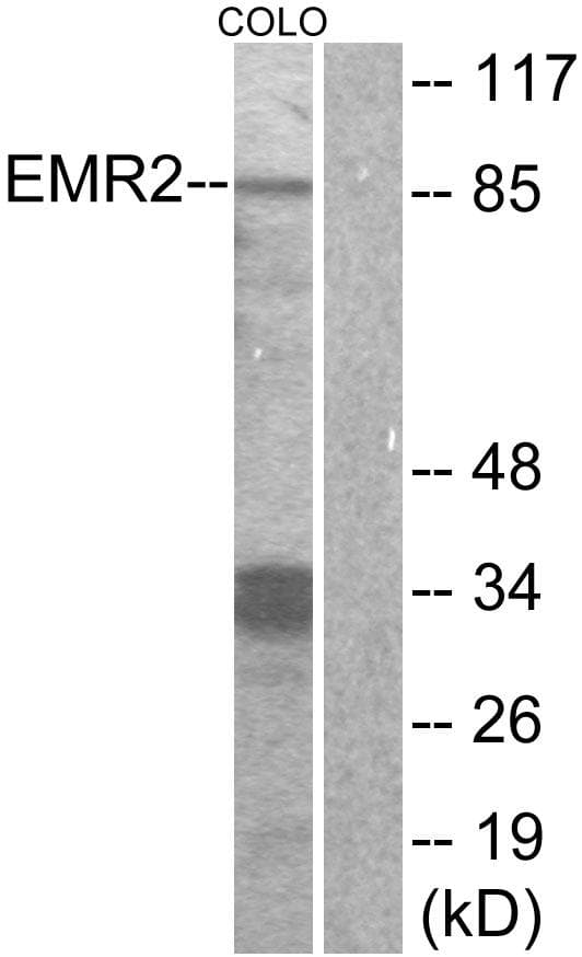 Polyclonal Rabbit anti-Human ADGRE2 / EMR2 Antibody (IF, WB)