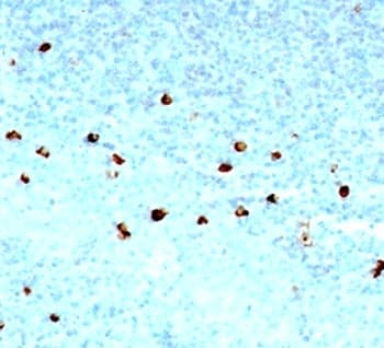 IGHM / IgM Antibody (clone SPM557)