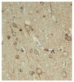 Polyclonal Rabbit anti-Human MAPT / Tau Antibody (phospho-Ser396, IHC, WB)