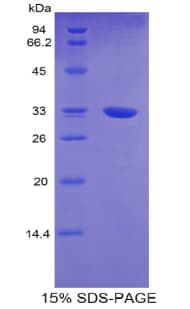 Mouse TNNT1 / TNT Protein (Recombinant His)