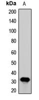CDCA8 / Borealin Antibody