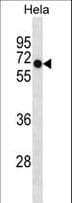 Polyclonal Rabbit anti-Human DEPDC7 Antibody (aa439-467, WB)