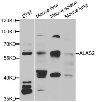 ALAS2 Antibody