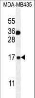S100A1 / S100-A1 Antibody (aa45-75)