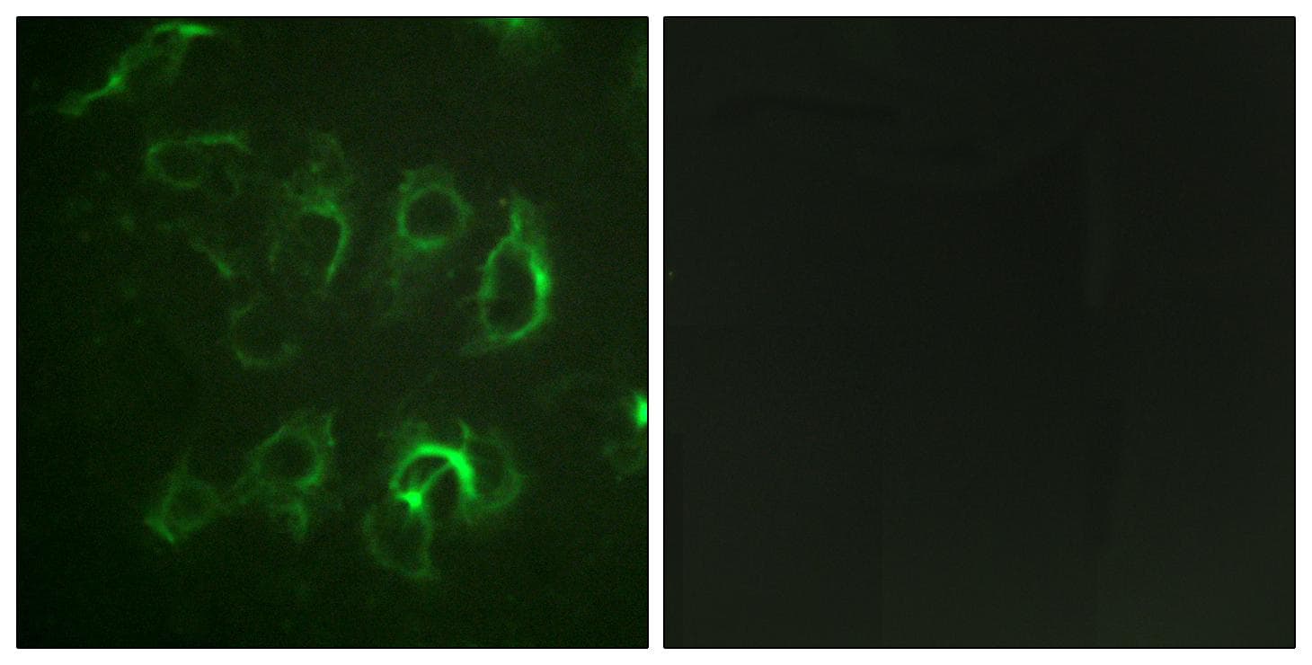 SCNN1B / ENaC Beta Antibody (Ab-615)