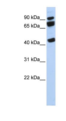 DDX17 Antibody (aa107-156)