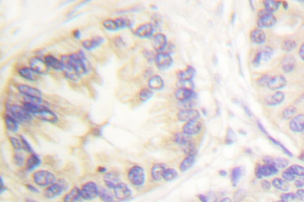 CASP9 / Caspase 9 Antibody (Glu119)