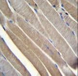 Polyclonal Rabbit anti-Human TRMT2B Antibody (aa136-165, IHC, WB)