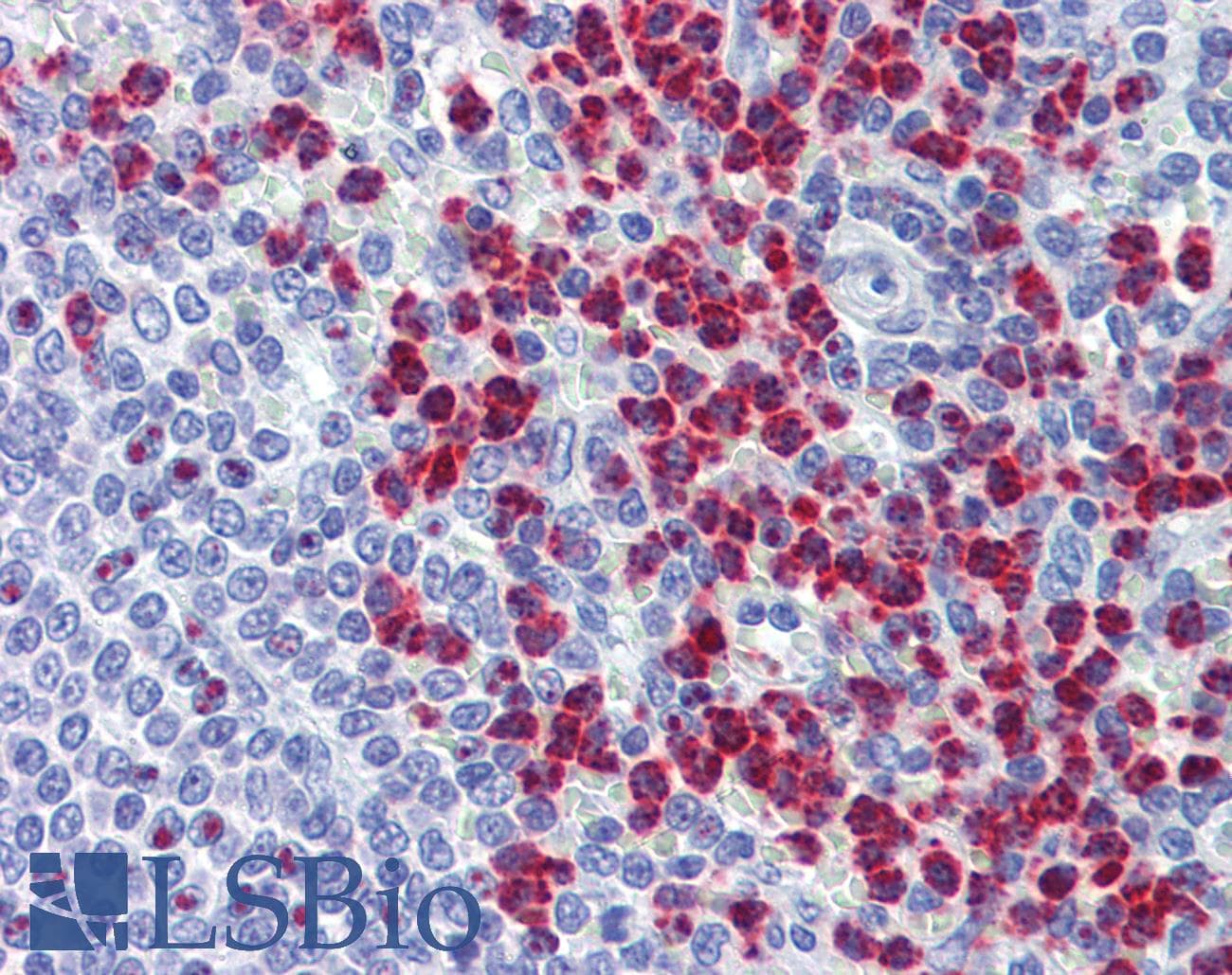 IHC-plus™ RASSF2 Antibody (aa11-22)