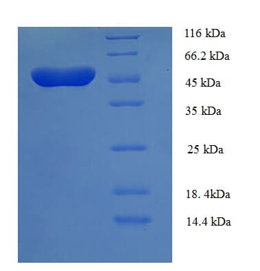 Human TEAD3 Protein (Recombinant His-SUMO)