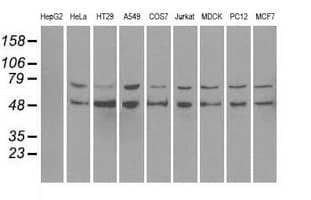 PPP5C Antibody (clone OTI6C2)