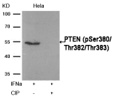 PTEN Antibody
