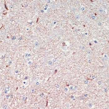 LRRK2 Antibody