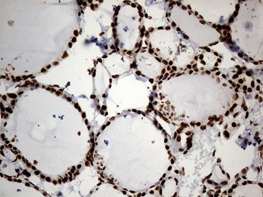 HNRNPH1 / hnRNP H Antibody (clone OTI2E8)