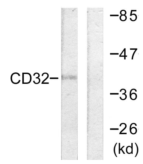 CD32B Antibody (p292)