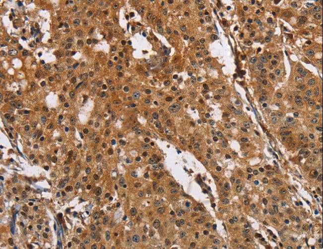 Polyclonal Rabbit anti-Human PTK6 / BRK Antibody (IHC)