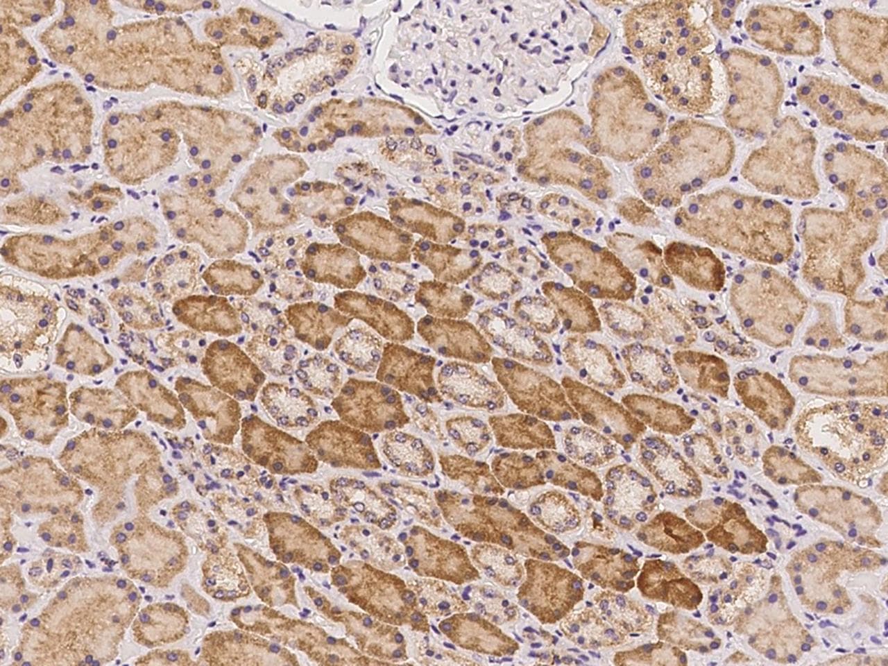 FLT4 / VEGFR3 Antibody
