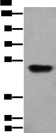 HNRNPH2 / hnRNP H2 Antibody