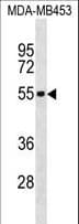 IL5RA / CD125 Antibody (aa391-420)