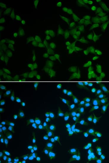 SPIN / SPIN1 Antibody