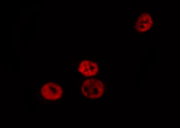 C/EBP Beta / CEBPB Antibody