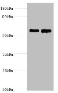 Polyclonal Rabbit anti-Human CNDP1 Antibody (aa1-280, IHC, WB)