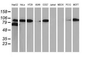CTNNB1 / Beta Catenin Antibody (clone UMAB15)