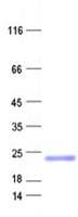 Human GSTZ1 Protein (Recombinant His, N-Terminal)