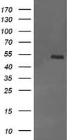 MDM4 / MDMX Antibody (clone OTI1E8)
