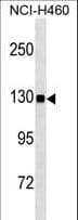 USP8 / UBPY Antibody (aa1-30)