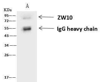 Polyclonal Rabbit anti-Human ZW10 Antibody (IF, WB)