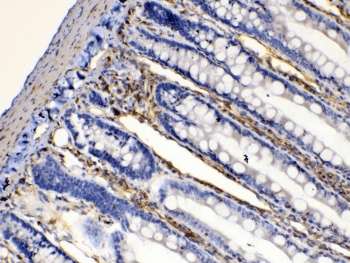 BAG1 / BAG-1 Antibody
