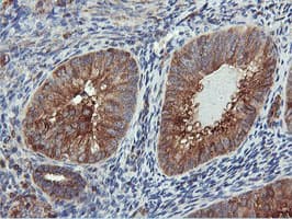 Monoclonal Mouse anti-Human PFKP Antibody (clone OTI3A12, IHC, IF, WB)